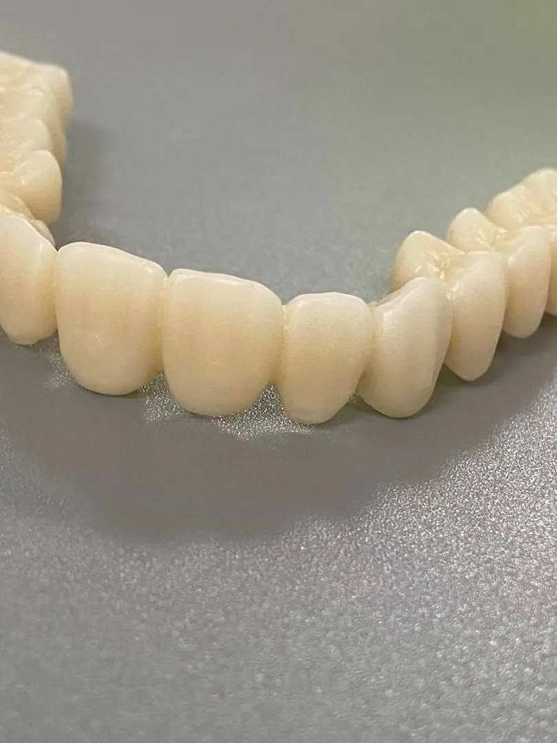 Dental Crown Material corona.dothome.co.kr