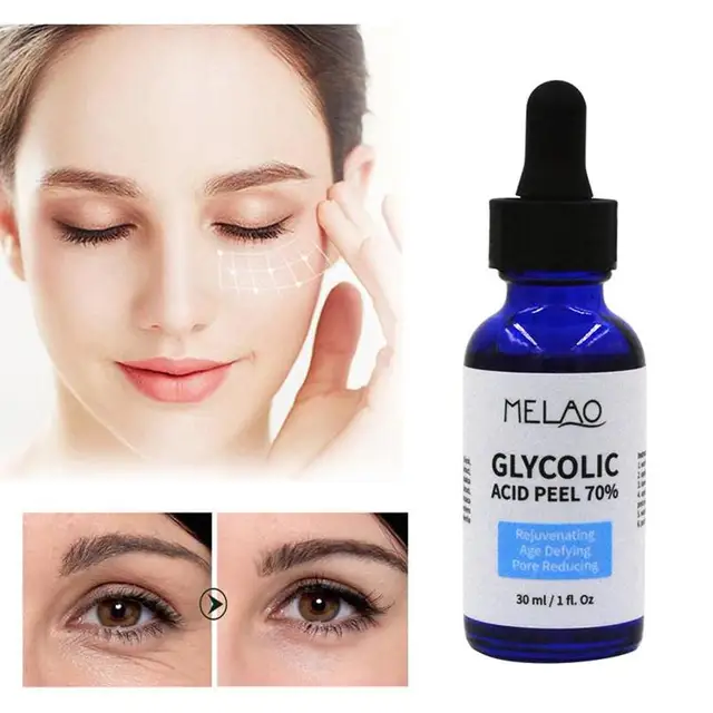 Glycolic Acid Peel 70 Serum Repair Skin Care Shrink Pores Brighten Acne Treatment Face Serum Moisturizing