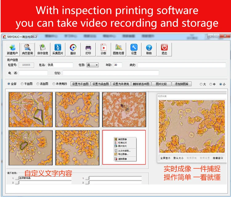 9英寸三目一滴血_21
