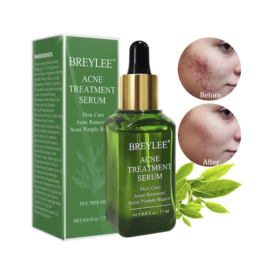 m skin care acne control serum