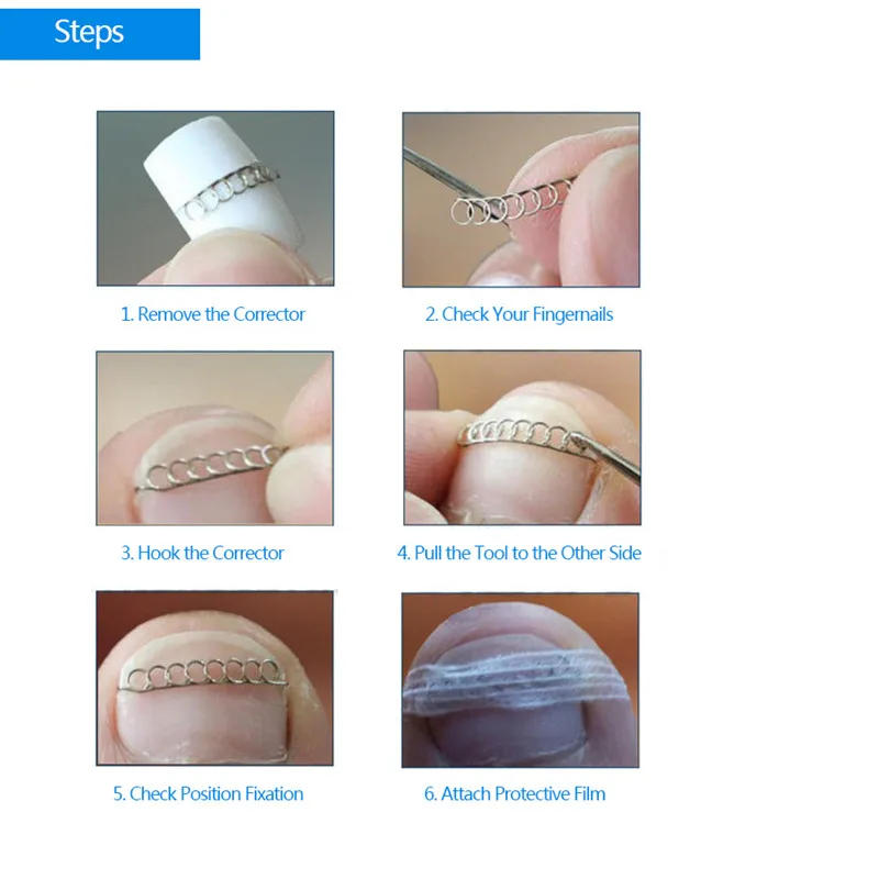 RORASA 12 шт. фиксатор для педикюра Восстанавливающий уход за ногами инструмент для коррекции ногтей Acronyx проволочный корректор для пальцев ног вросшие ногти