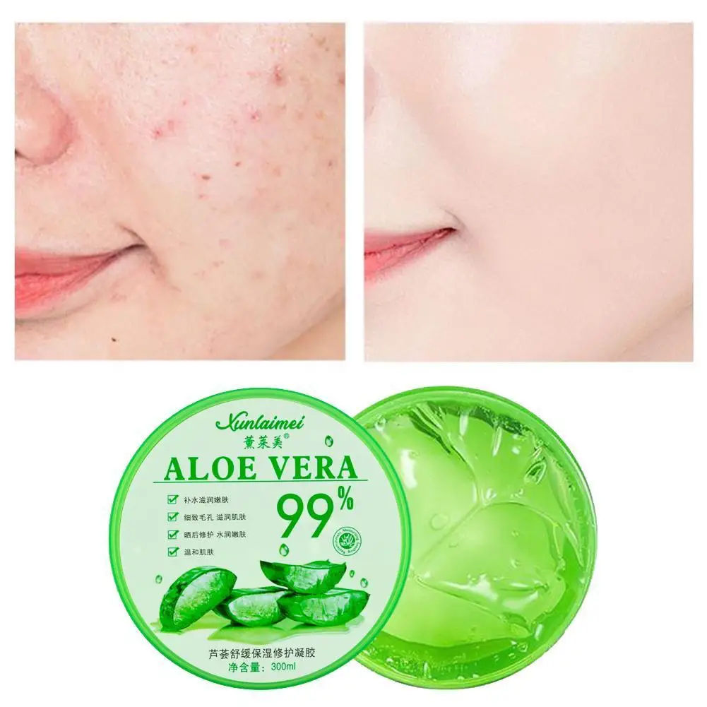 300g 99 Aloe Vera Soothing Repair Gel Moisture Nourishing Remove Acne