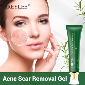 

BREYLEE Acne Scar Remover Gel Acne Treatment Fade Acne Marks Soothing Repairing Face Serum Facial Essence Beauty Skin Care 30g