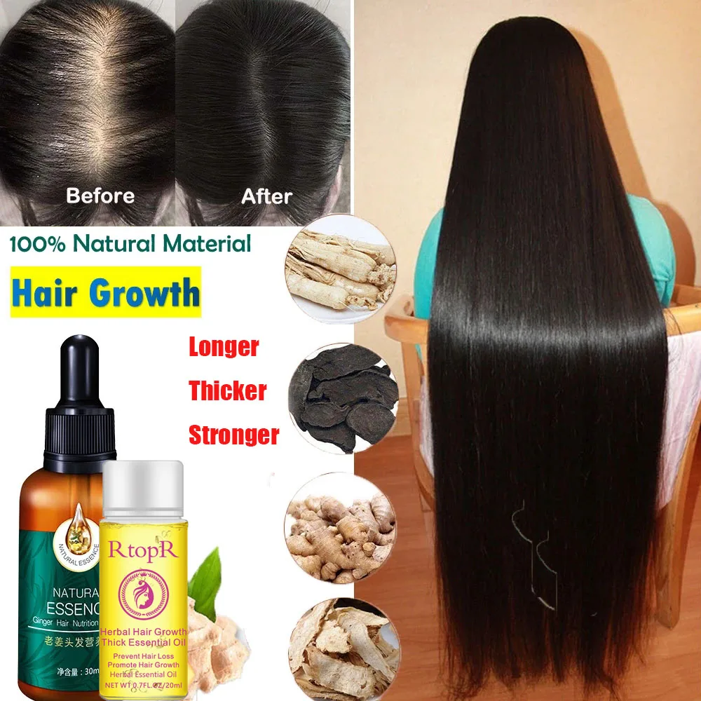 

30ML Natural Ginger Hair Growth Essence Plant Oil Anti-Hair Loss Nutritious Liquid Longer Thicker Hair Care Treatment Serum