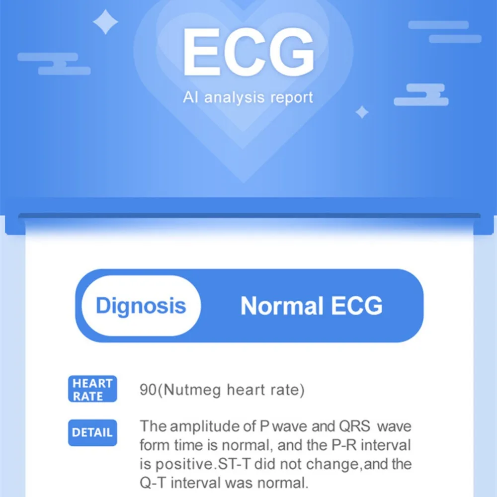 ECG PPG смарт-Браслет фитнес-трекер Шагомер Калории пульсометр кровяное давление Смарт-часы браслет для мужчин и женщин