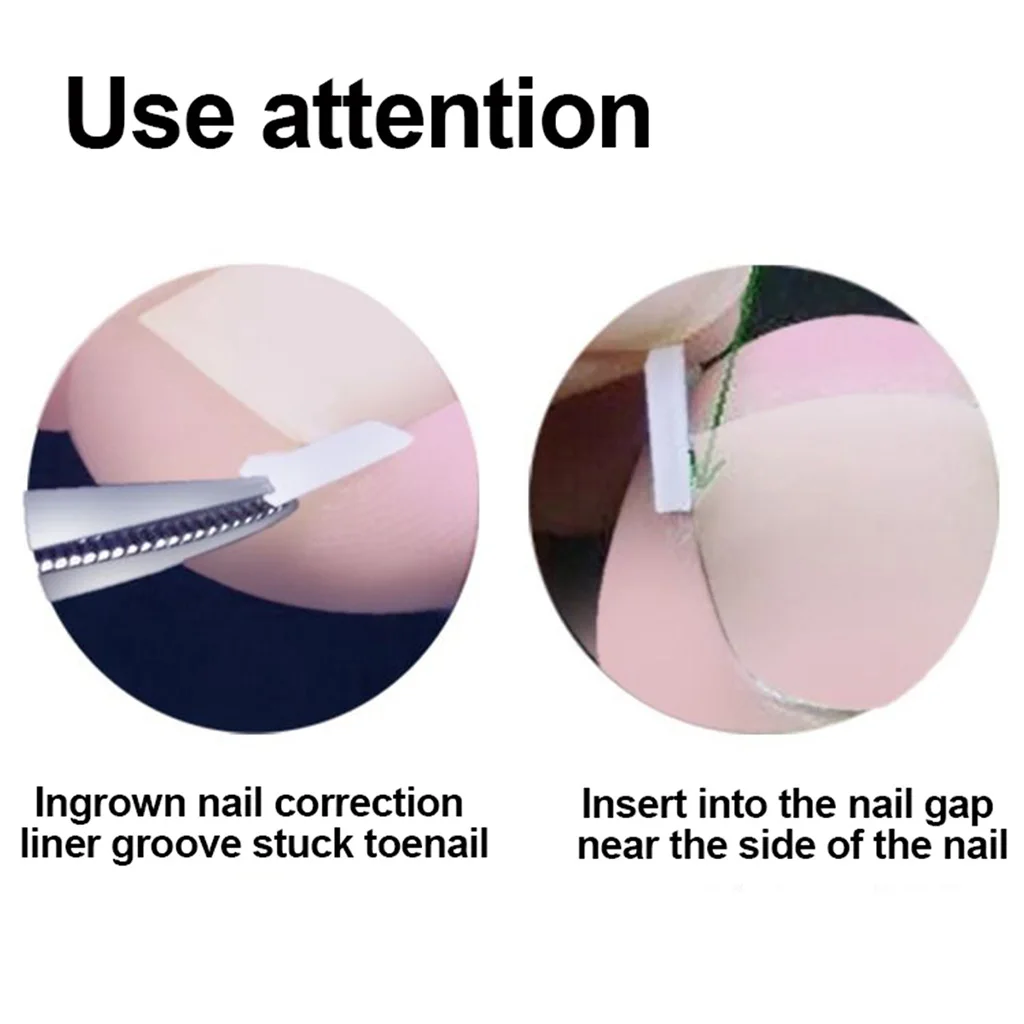 Toe Nail File Foot Nail Care Ingrown Double Ended Ingrown Toe Correction Lifter File with Glue Manicure Pedicure Toenails Tool