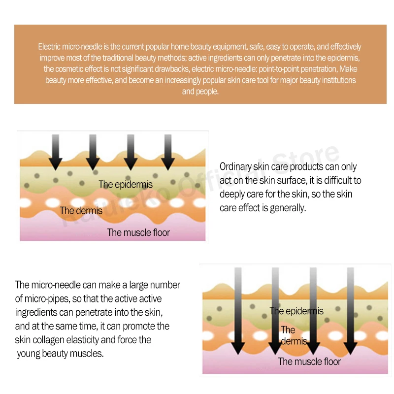 Штыковый картридж иглы для Dr.pen Nano/9 Pin/12 Pin/36 Pin/42 Pin Microneedling Сменные головка MYM штамп