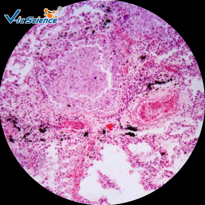 

Hot Sale 200pcs Histology Pathological Prepared Slides