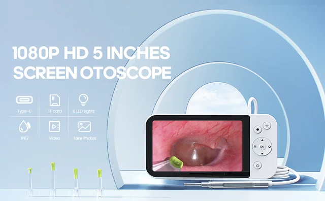 Caméra otoscope numérique de 3,5 mm avec lumière, caméra visuelle et pince  à épiler pour