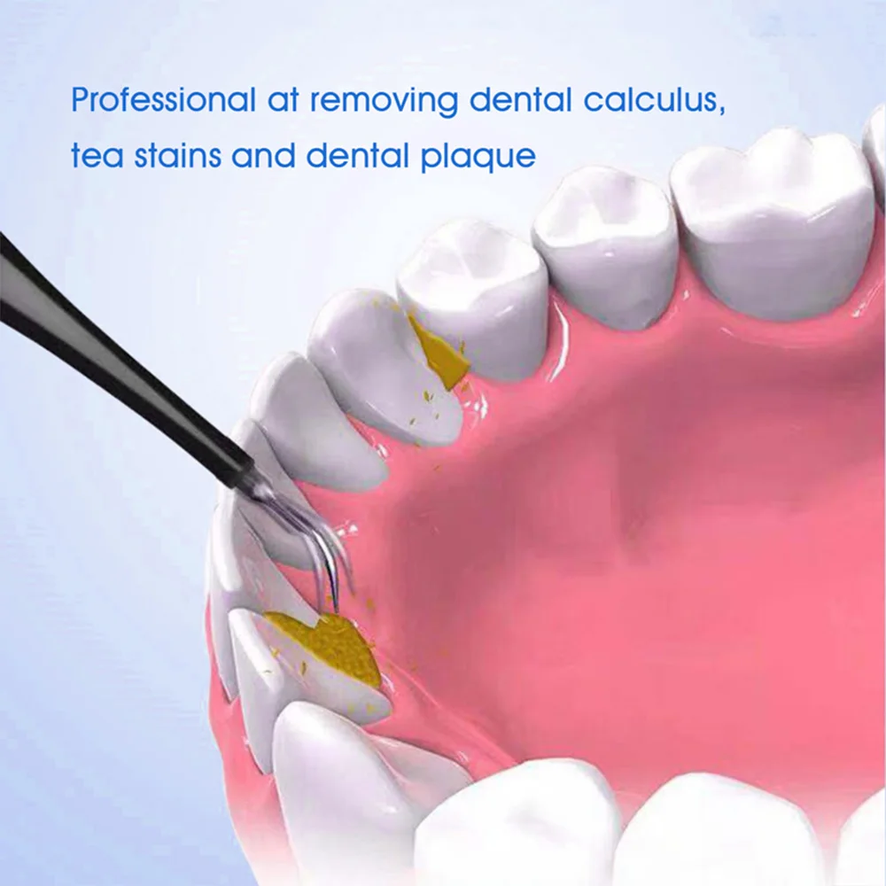 Электрический Ультра звуковой зубной зуб для удаления пятен зубного камня Philips