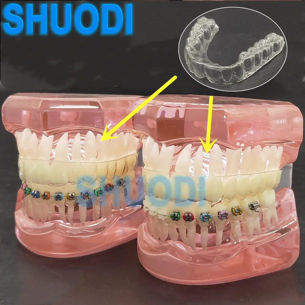 Стоматологическая модель зуба Ортодонтическая для общения с пациентом зубов