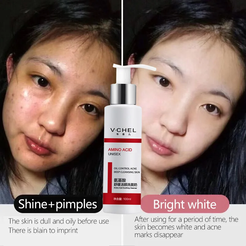 

WXE Amino Acid Bubble Moisturizing Facial Pore Cleanser Face Washing Product Face Skin Care Anti Aging Wrinkle Cleansing