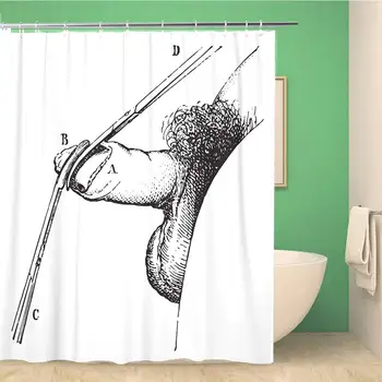 

Bathroom Shower Curtain Operation of Phimosis by Circumcision Vintage Engraved Usual Medicine Polyester Fabric 72x78 inches