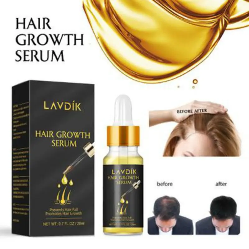 Сыворотка для быстрого роста волос LAVDIK имбирь эфирное масло против выпадения волос жидкость для восстановления поврежденных волос растущее женское и мужское 20 мл