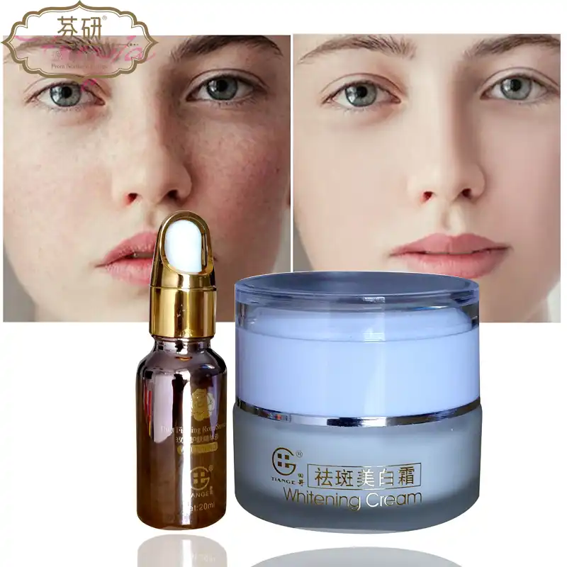 anti freckle cream