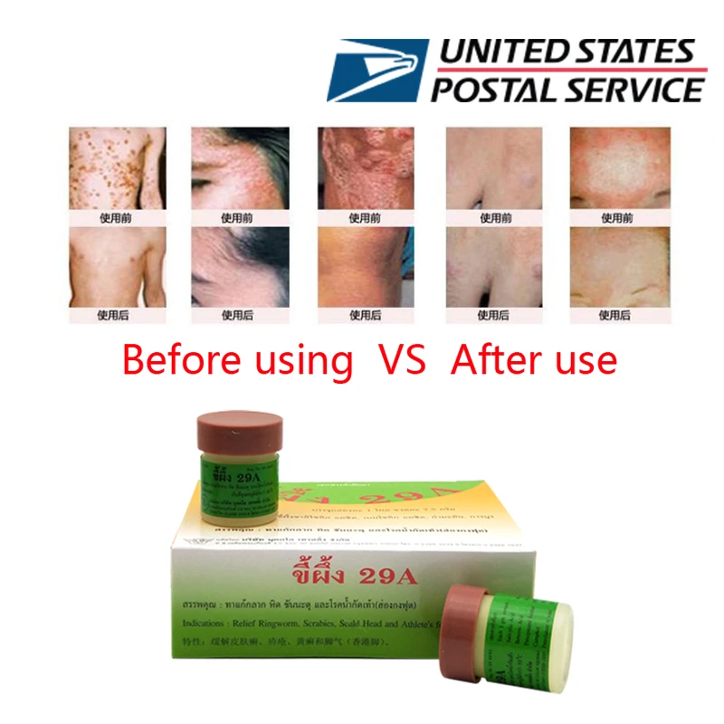 thailand 29a natural ointment psoriasi eczma cream works really well for dermatitis psoriasis eczema urticaria beriberi body self tanners bronzers aliexpress
