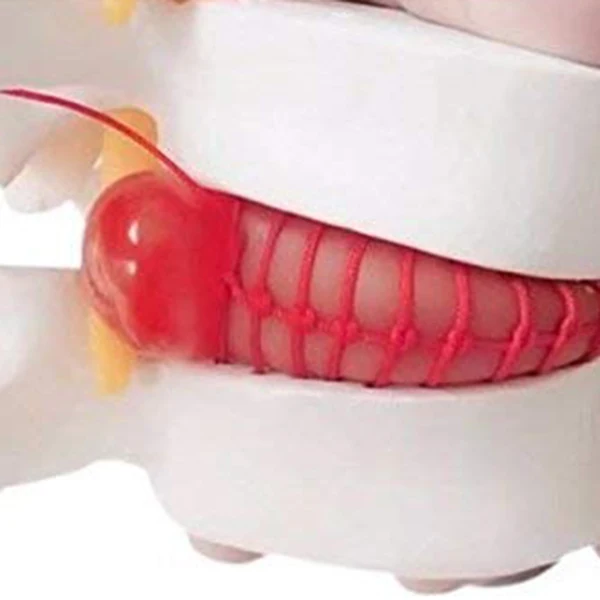 1 шт. анатомический Поясничный диск грыжа поясничного отдела позвоночника модель белого цвета FP8