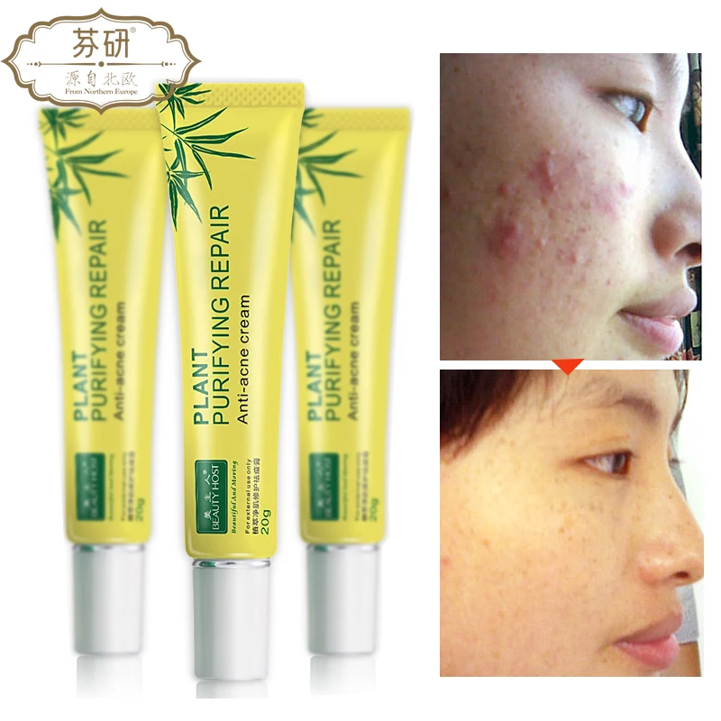 Крем для ухода за кожей лица от акне 20 г|skin care|acne treatmentanti acne |