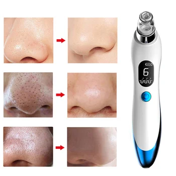 

Electric Vacuum Suction Cleaner Face Cleaning Blackhead Removal Black Spot Facial Cleansing Machine Skin Scrubber Pore Cleanser