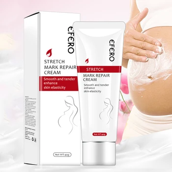

1PCS Mild Stretch Marks Repair Cream Firming Skin Pregnancy Scars Removal Cream Body Cream Maternity Repair Skin Care Treatment