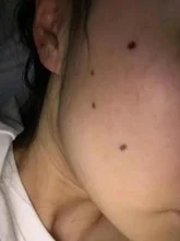 9 engranajes bolígrafo de Plasma láser Etiqueta de piel de Topo removedor de pecas verruga tatuaje mancha removedor multifunción LCD herramienta de belleza