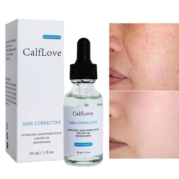 

Deep Moisturizing Face Serum Hydrating Smoothing Relieve Dryness Skin Repair Reddish Essence Shrinking Pores Remove Acne Care