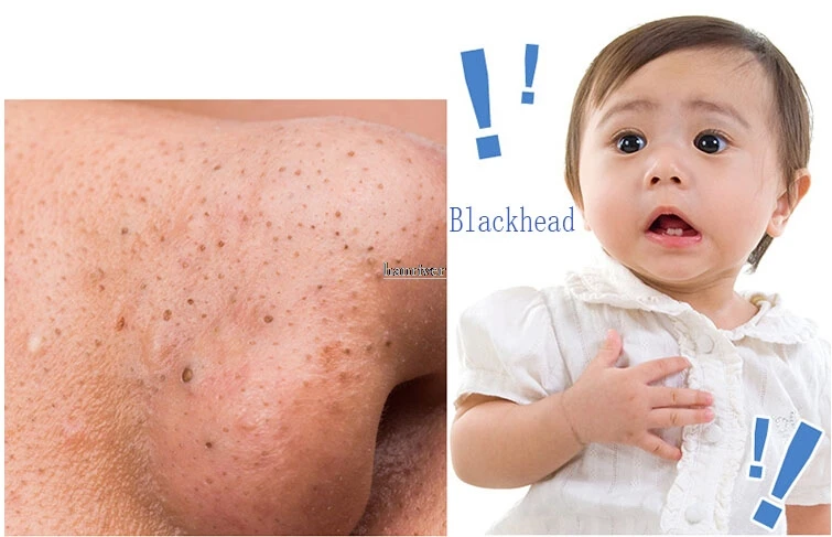 HTB1LWHxQpXXXXXKXFXXq6xXFXXXi