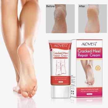 

Moisturizing Cream For Frostbite Chilblain Prevention Feet Care Cream Мазь От Псориаза Breast Enlargement