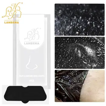 

1PC Nose Skin Care Black Mask Deep Cleansing Blackhead Remove Strawberry Treatment Face Masks Nose Sticker Pig Nose Mask TSLM2