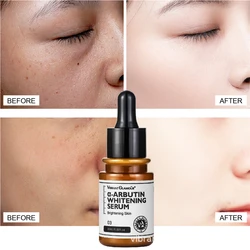 VIBRANT GLAMOUR Arbutin Whitening Serum Brighting Moisturizing Essence Reduce Dullness Spot And Acne Marks Facial Skin Care 30ml