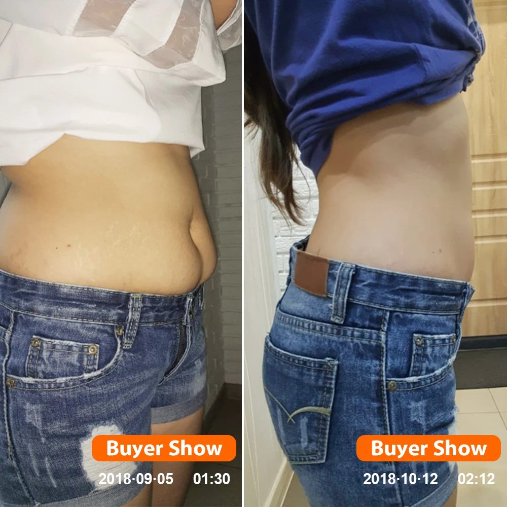 KONGDY-Hot-Sale-Slimming-Sticker-100-Pieces-10-Bags-Slimming-Navel-Sticker-5x8-cm-Slim-Patch