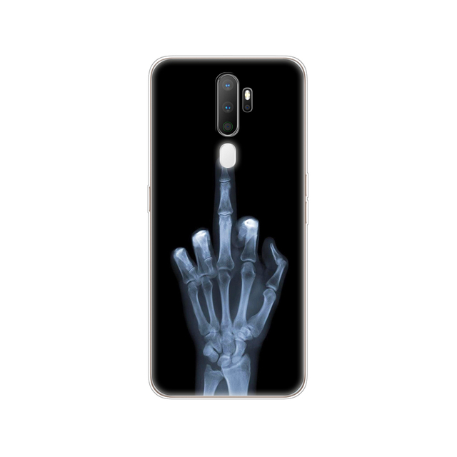 For Oppo A9 A5 2020 Case Soft TPU Phone Shell Back For OPPOA9 OPPOA5 A 9 Coque A 5 Cover Silicon Protective Funda 6.5" cat