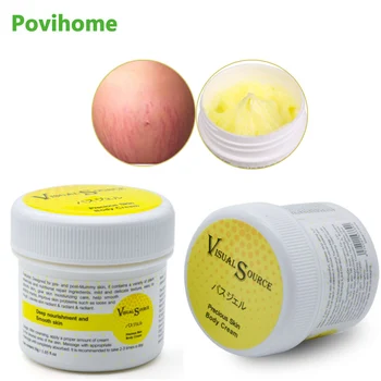 

1Pcs Stretch Mark Cream Natural Herbal Mild Non-irritating Scar Removal Pregnancy Ointment Precious Skin Body Care Cream