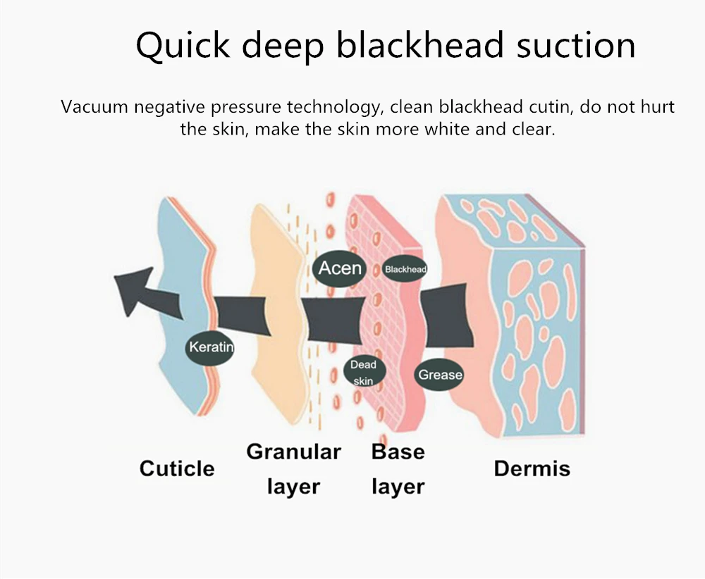 Средство для удаления черных точек вакуумный аппарат для очистки пор от акне и комедонов средство для удаления черных точек уход за лицом инструменты для ухода за кожей