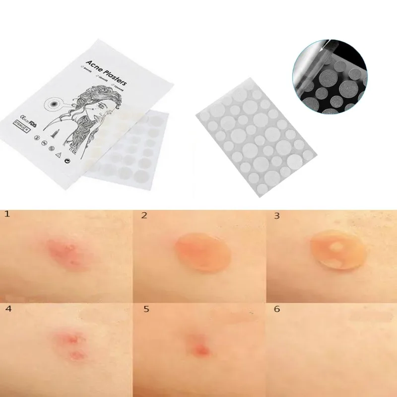 

Invisible Acne Removal Pimple Patch Can Absorb Acne Secretions Effectively Fast Healing Suitable Acts As Protective Cover 36pcs