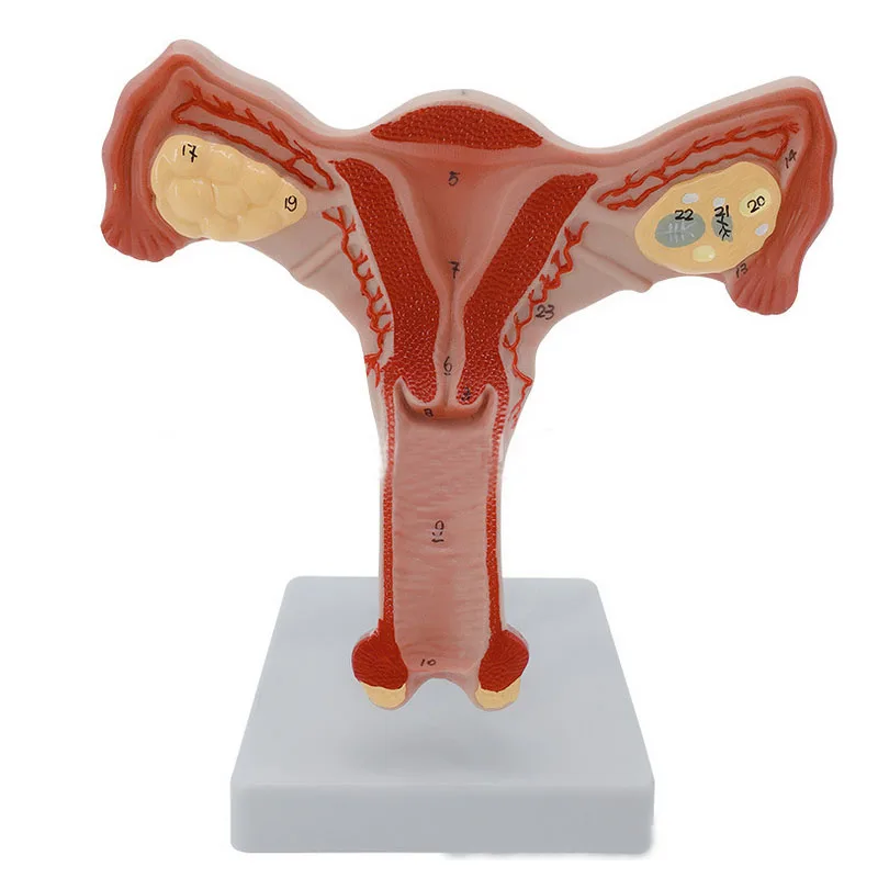 

Normal Ovary Uterus Demonstration Model