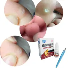  Skin Tag Remover 12 hours Medical Remover Against Skin Wart Foot Tag Liquid & Mole Corn Removal Genital Treatment Anti Verr P1I8 