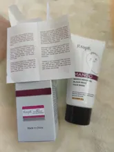Nose-Mask Oil-Control Blackhead-Remover Skin-Care Acne-Treatment Rtopr Mango Deep-Cleansing