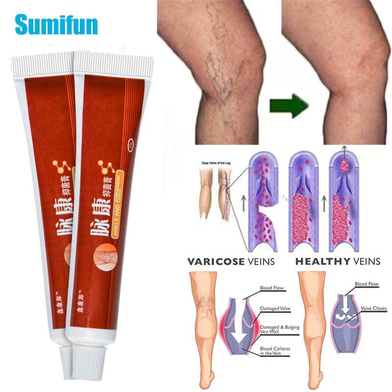 Спрей от варикоза. Varicose veins инструкция. Крем против венозного расширения вен. Varicose veins инструкция. Varicose veins patch инструкция по применению.