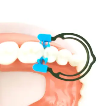 

Dental Sectional Contoured Metal Spring Clip Teeth Matrix Ring 667D