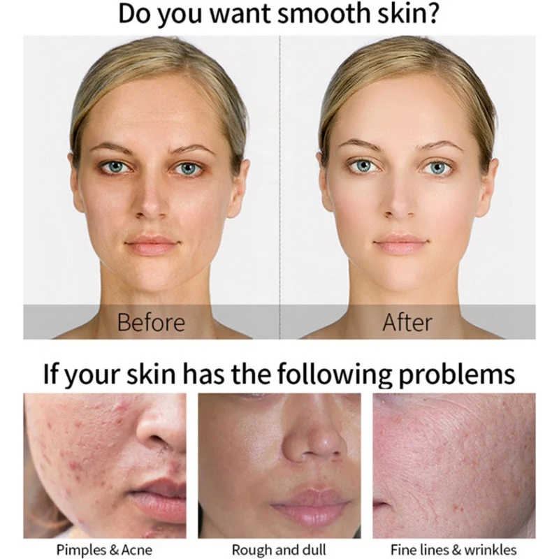 MATRIXYL 3000 Serum Vitamin C Hyaluronic Acid Reduce Sun Spots And Wrinkles MATRIXYL 3000 Serum Vitamin C Hyaluronic Acid Reduce Sun Spots And Wrinkles