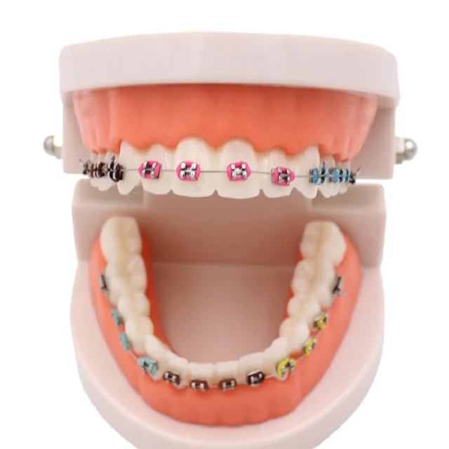 Dental ortodontyczne leczenie Model z Ortho metalowy uchwyt ceramiczny łuk drut tubka dentystyczna podwiązki dentysta narzędzia Lab 2