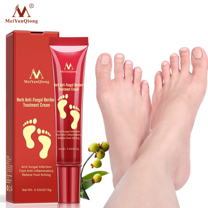 Anti Fungal Beriberi Foot Cream Treatment Infection Onychomycosis Paronychia Toe Fungus Gel