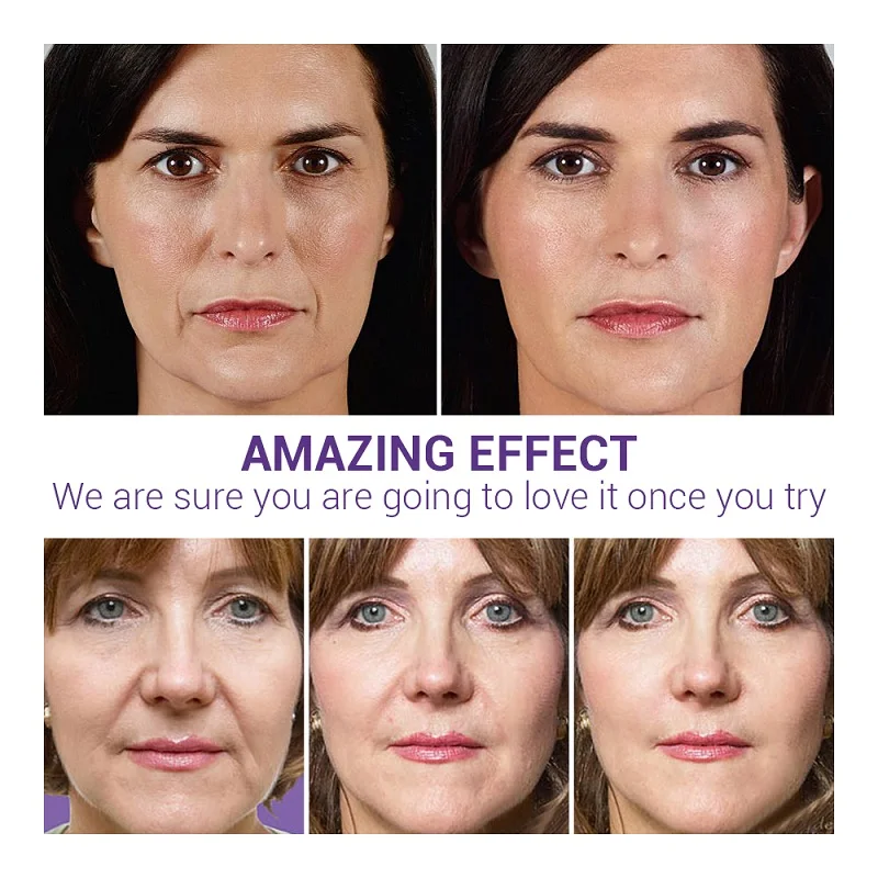 LANBENA Face Serum Essence Hyaluronic Acid 24K Gold Anti-Aging Vitamin C Whitening Blackhead Acne Remover Moisturizing Skin Care LANBENA Face Serum Essence Hyaluronic Acid 24K Gold Anti-Aging Vitamin C Whitening Blackhead Acne Remover Moisturizing Skin Care