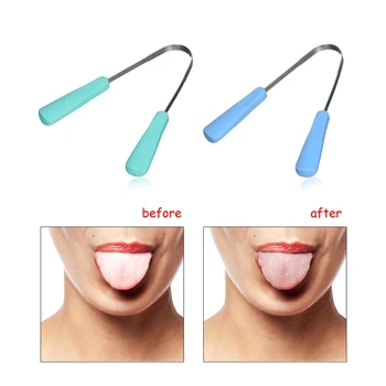 

Stainless Steel Tongue Coating Device ABS Handle To Remove Bad Breath, Clean Tongue Coating, Tongue Scraper, Oral Hygiene Tool