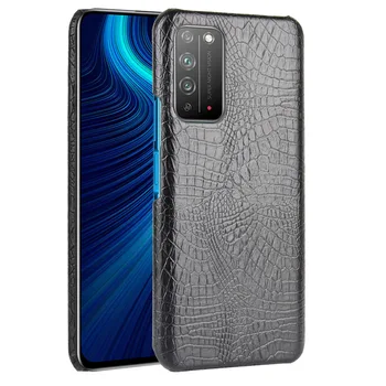 

New ZV01 serpentine back case for huaweihonorX10 elegant phone case