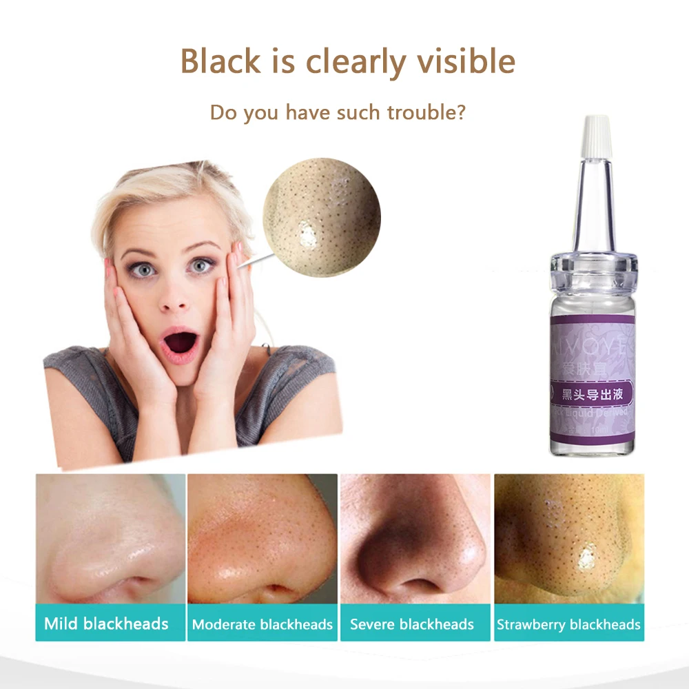 

AFY Deep b lackhead Export Liquid Chinese Medicine To Acne Shrink Pores Softening & Quick Export Black Head Face Skin Care
