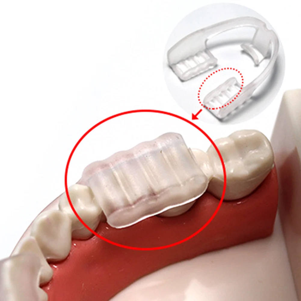 Convenient Eliminates Anti Snoring Mouth Grind Dental Guard Anti Grinding Night Mouthguard Prevent Bruxism Teeth Protector 3