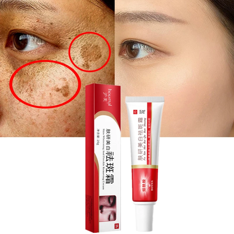 Крем против веснушек отбеливающий Невидимый крем для пятен блестящий нежный не