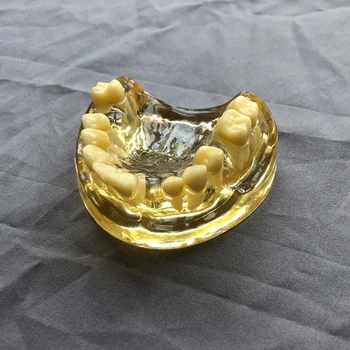 

ENOVOMODEL Transparent Dental Jaw Model